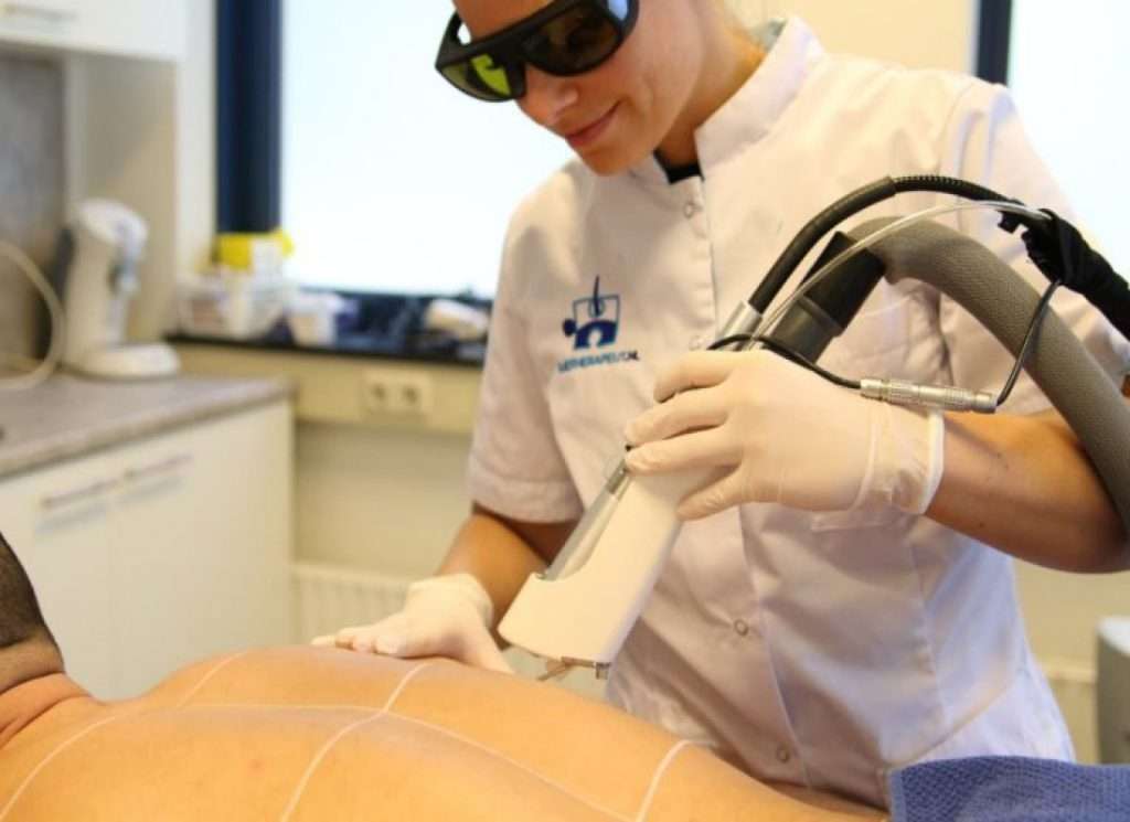 لیزر موهای زائد بدن