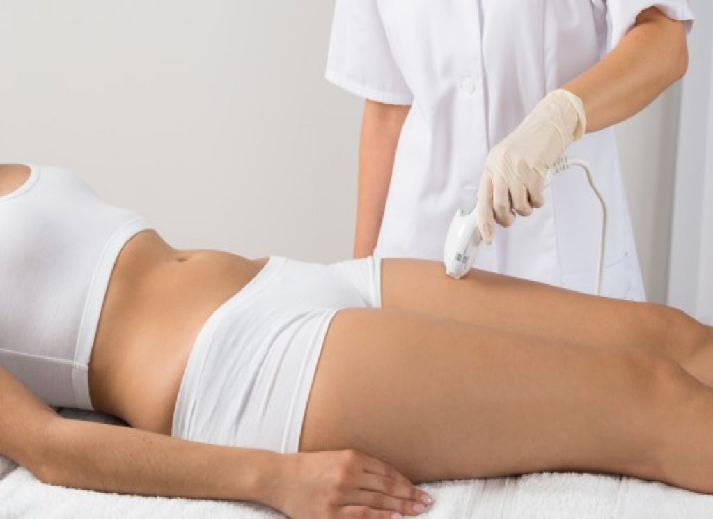 لیزر موهای زائد خط بیکینی