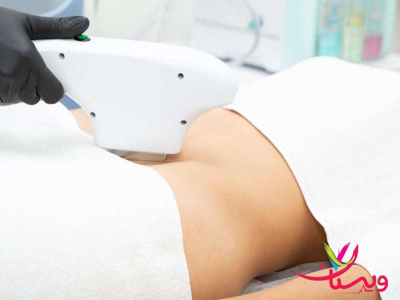 آمادهسازی قبل از جلسه (مثل تمیز کردن پوست) میتواند فرآیند را سریعتر و راحتتر کند. 5 نکته برای اینکه لیزر موهای زائد شما را کمتر خجالت آور کند