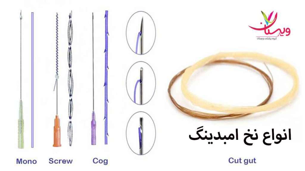 انواع نخ لاغری انواع نخ امبدینگ