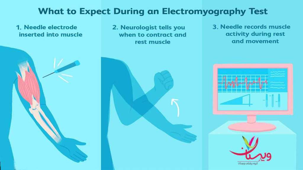 تفسیر نوار عصب و عضله تفسیر نوار عصب