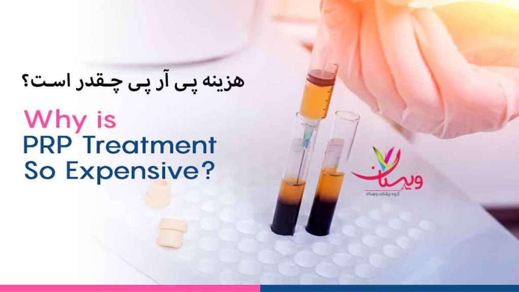 هزینه پی ار پی هزینه پی آر پی