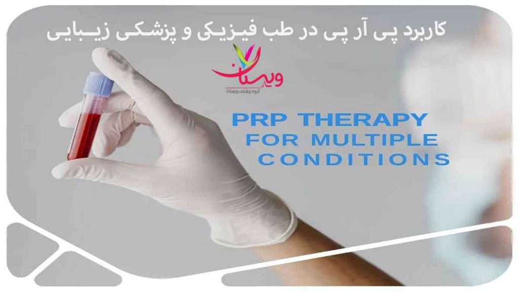 کاربرد پی ار پی پی ار پی در طب فیزیکی