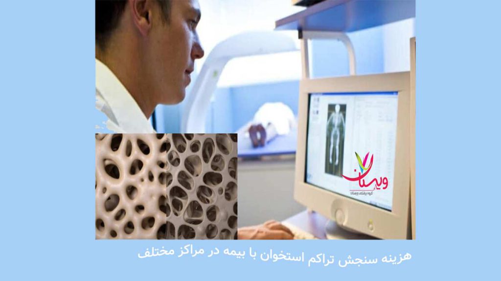 هزینه سنجش با بیمه در مراکز مختلف هزینه سنجش تراکم استخوان با بیمه تامین اجتماعی