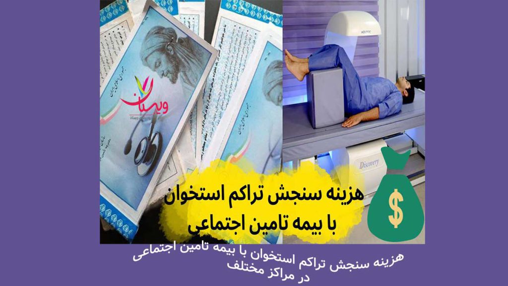 نحوه محاسبه سنجش تراکم استخوان در مراکز مختلف هزینه سنجش تراکم استخوان در مراکز مختلف چگونه محاسبه میشود؟