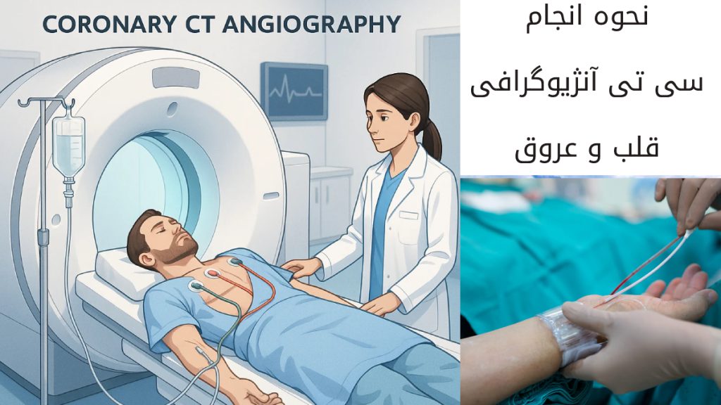 مراحل سی تی انژیو قلب بیمار روی تخت دراز کشیده آنژیوکت به دست وصل و آماده سی تی انژیو گرافی است