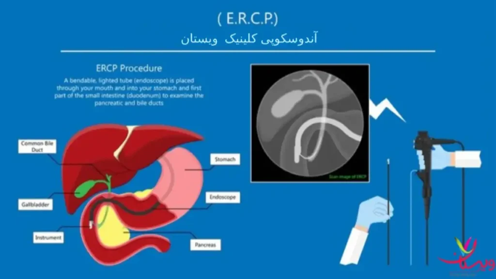 مرکز آندوسکوپی ویستان مرکز آندوسکوپی مجاری صفراوی