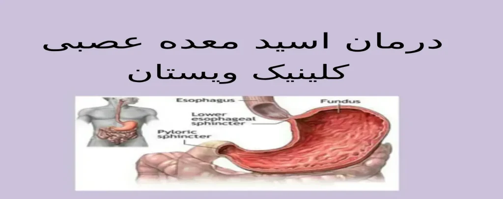 پیشگیری از اسید معده عصبی ویستان پیشگیری از اسید معده عصبی