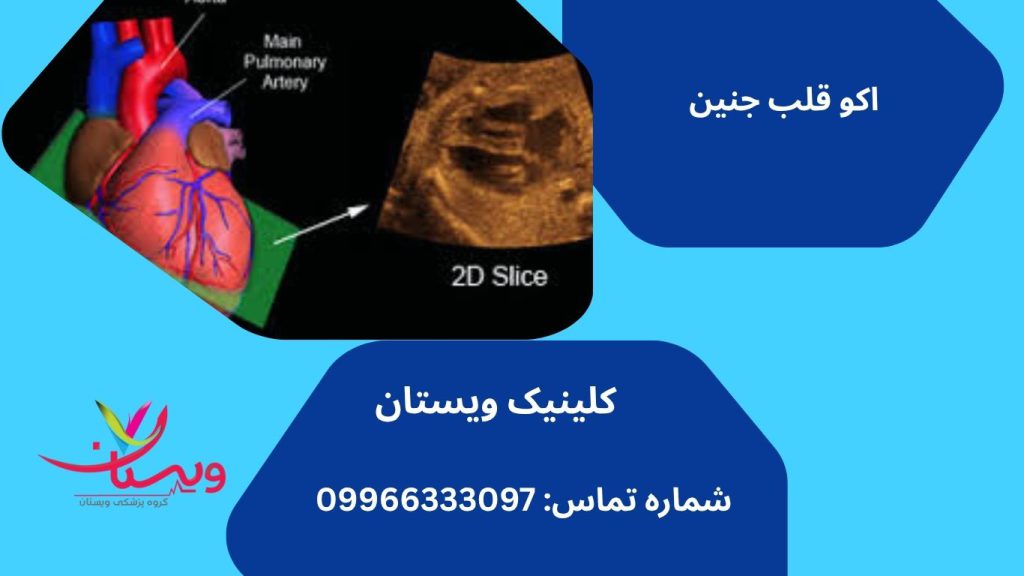 اکو قلب جنین در کرج نی نی سایت