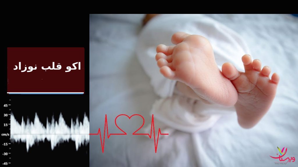 اکو قلب نوزاد برای چیست