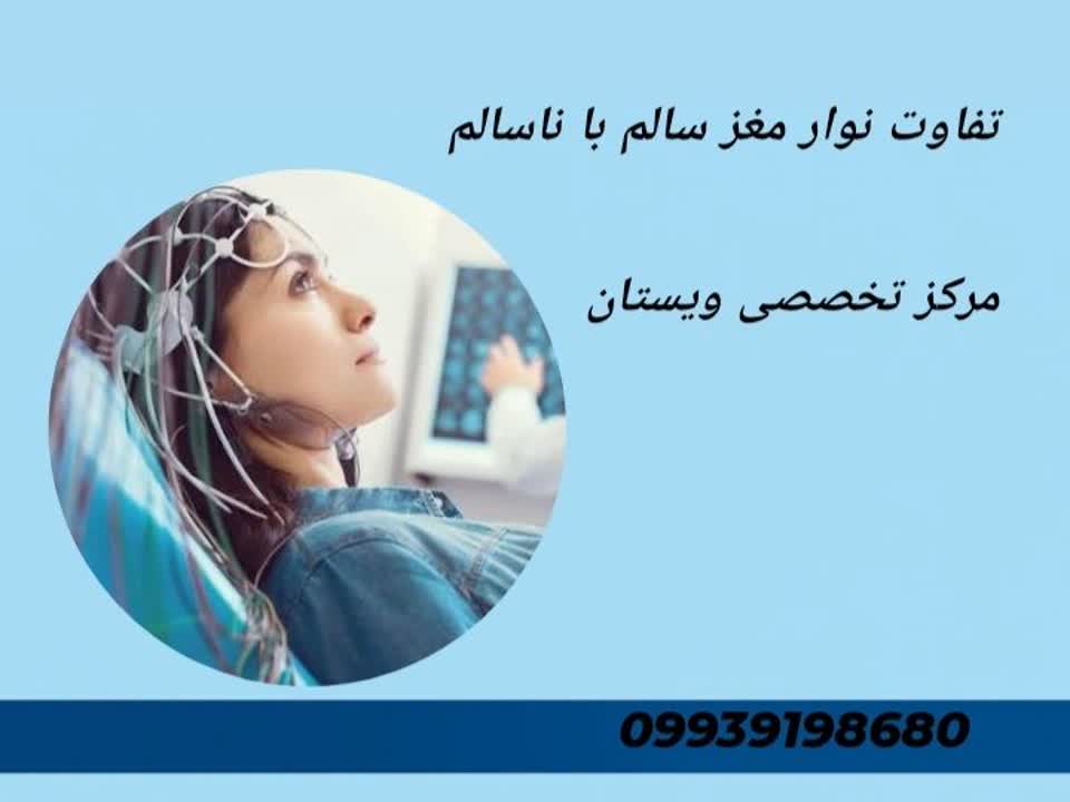 انواع امواج مغزی، نشانه سلامت مغز، اختلالات شایع، تحلیل امواج در EEG تفاوت نوار مغز سالم با ناسالم