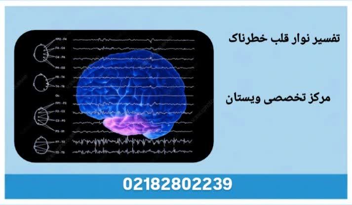 تشریح الگوی نوار قلب خطرناک و تفاوت آن با نوار قلب نرمال نوار قلب خطرناک