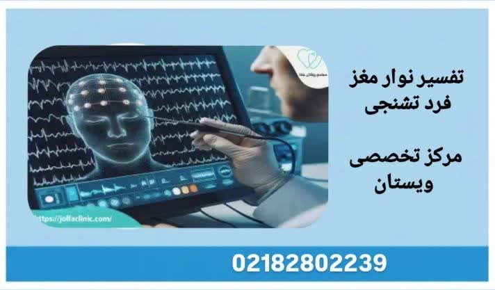 امواج تشنجی را در نوار مغز امواج تشنج در نوار مغز