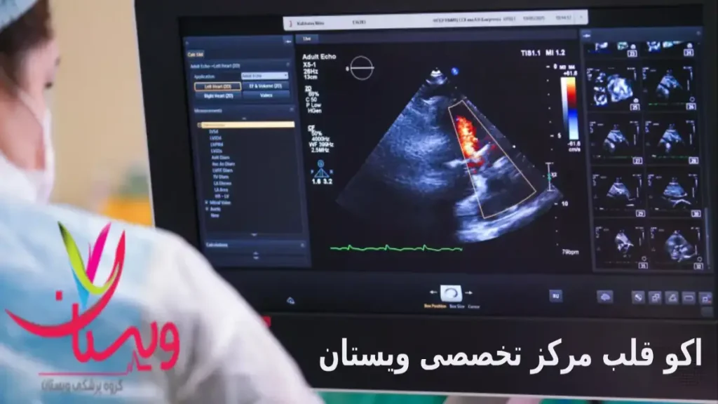 در اکو قلب چه چیزی مشخص میشود