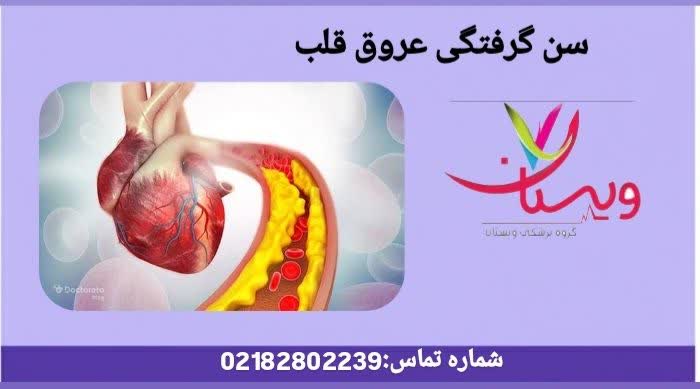 بررسی سنین شایع ابتلا به گرفتگی رگهای قلب و عوامل تسریعکننده در بروز آن. سن گرفتگی عروق قلب