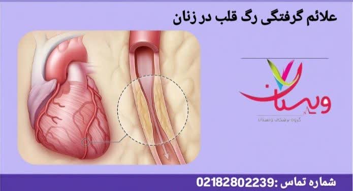 گرفتگی عروق قلب در زنان علائم گرفتگی رگ قلب در زنان