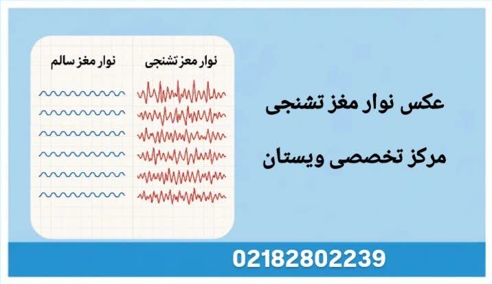 تصویر نوار مغز تشنجی