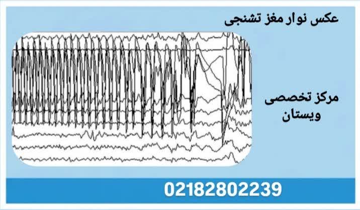 نوار مغز غیر نرمال عکس نوار مغز تشنجی