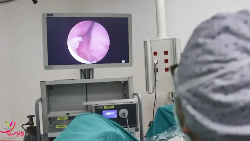 آندوسکوپی معده ویستان آندوسکوپی معده