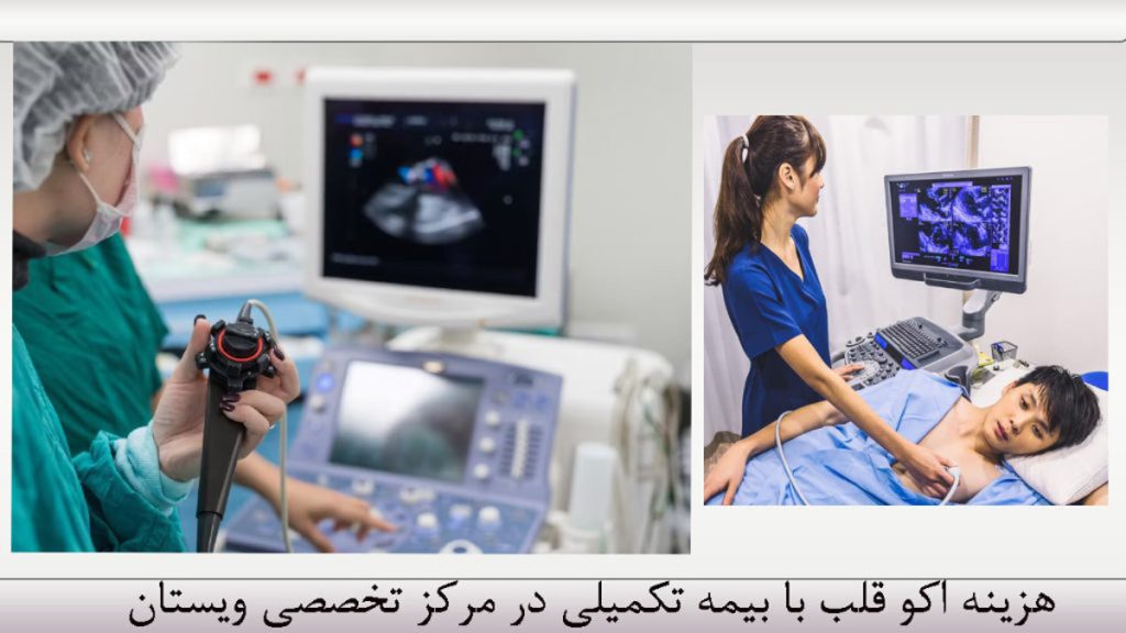 اکو قلب با بیمه تکمیلی کرج + بهترین مرکز اکو و نوار قلب کرج