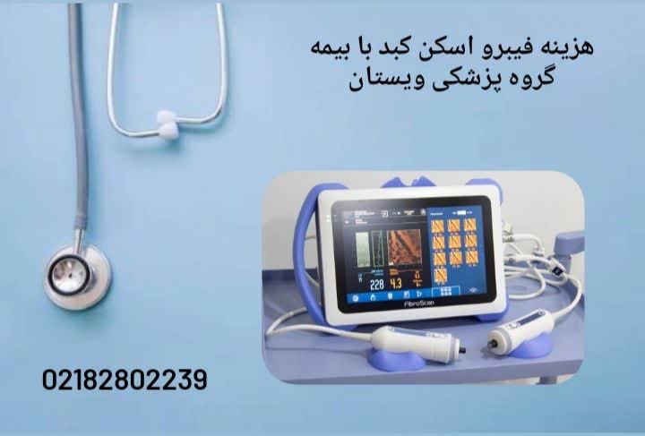 هزینه فیبرو اسکن کبد هزینه فیبرو اسکن کبد