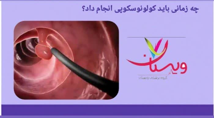 چه زمانی باید کولونوسکوپی انجام داد؟