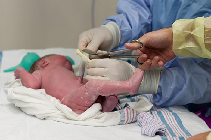 سزارین شکم اول