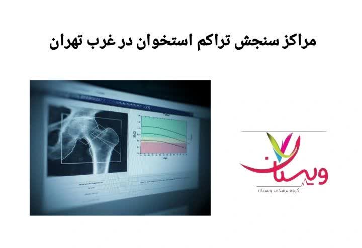 معرفی مراکز مجهز و معتبر در مناطق غربی تهران با دسترسی آسان، نوبتدهی سریع و تفسیر تخصصی نتایج مراکز سنجش تراکم استخوان در غرب تهران