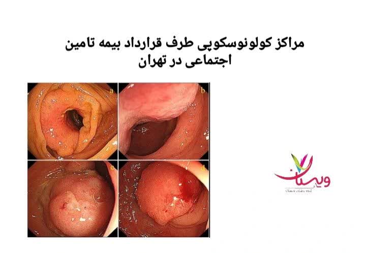 معرفی مراکز تخصصی گوارش و آندوسکوپی مراکز کولونوسکوپی طرف قرارداد با بیمه تأمین اجتماعی
