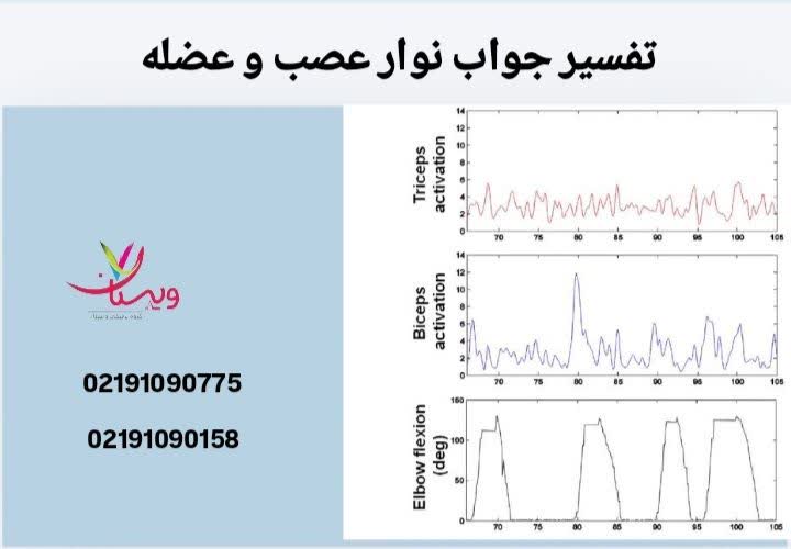 تحلیل تخصصی دادههای نوار عصب و عضله برای تشخیص مشکلات عصبی یا عضلانی. تفسیر جواب نوار عصب و عضله