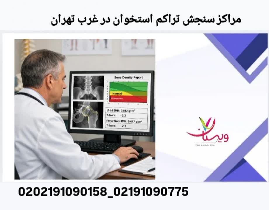 لیست مراکز معتبر سنجش تراکم استخوان در غرب تهران مراکز سنجش تراکم استخوان در غرب تهران