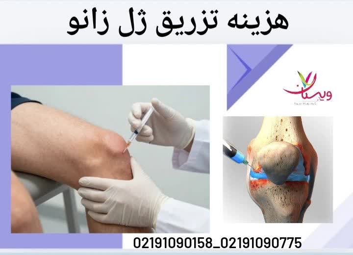 هزینه تزریق ژل زانو