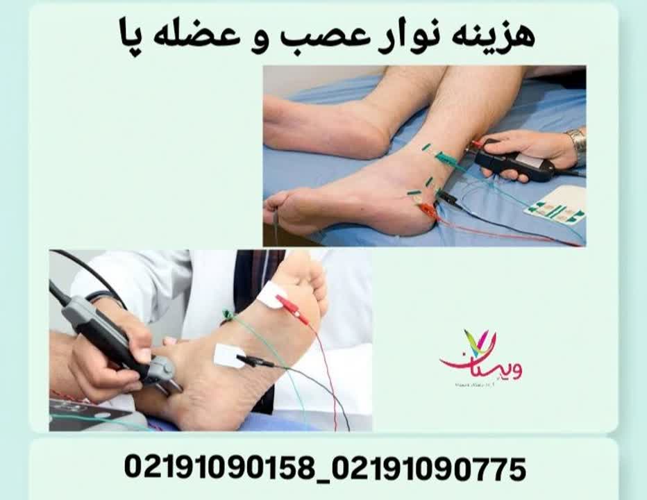 بررسی هزینه انجام نوار عصب و عضله پا هزینه نوار عصب و عضله پا