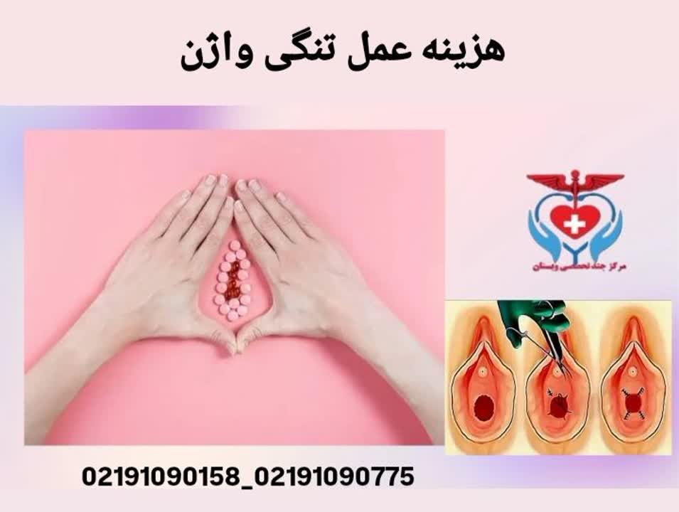 هزینه عمل واژینوپلاستی