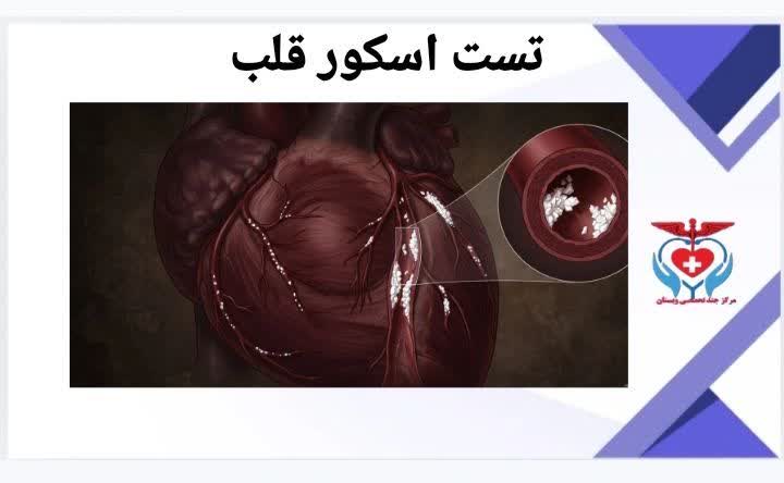 کلسیم اسکور قلب